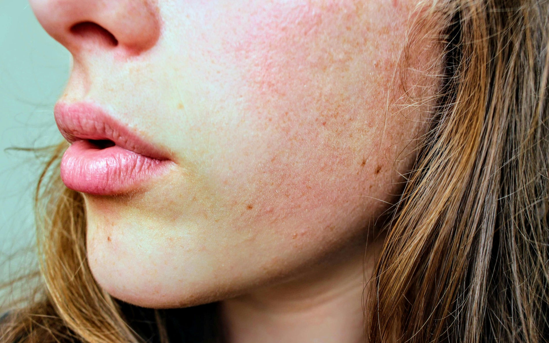 skincare voor droge huid
